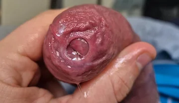 Uncut Head Precum Play