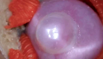 The Camera Inside the Deep Pussy Records a Huge Ejaculation with a Stuck Condom 4K