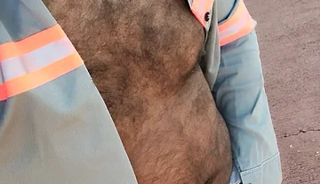 My Hairy Body