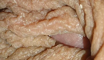 The World's Largest Foreskin Opening and Closing.